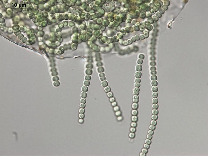 Stark vergrößerte Aufnahme einer Cyanobakterie