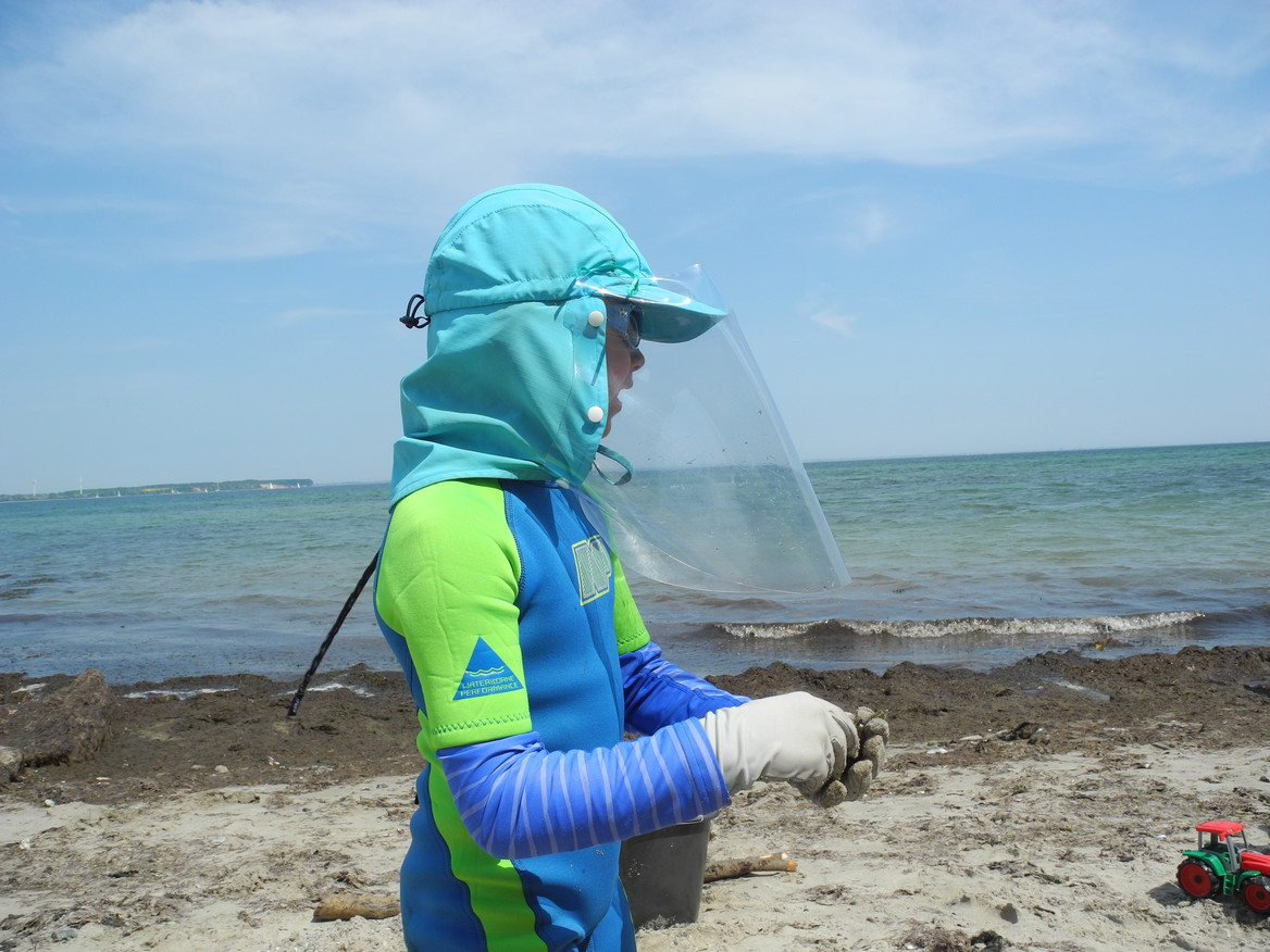 Nur mit komplettem UV Schutz, darunter der Folie von Renolit, sind XP-Erkrankte wie dieses Kind am Strand vor den für sie lebensgefährlichen Sonnenstrahlen abgeschirmt. Foto: Selbsthilfegruppe XP-Freunde